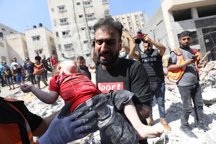 UNRWA: Setiap Hari Sepuluh Anak Palestina Kehilangan Satu Atau Dua Kakinya Di Gaza